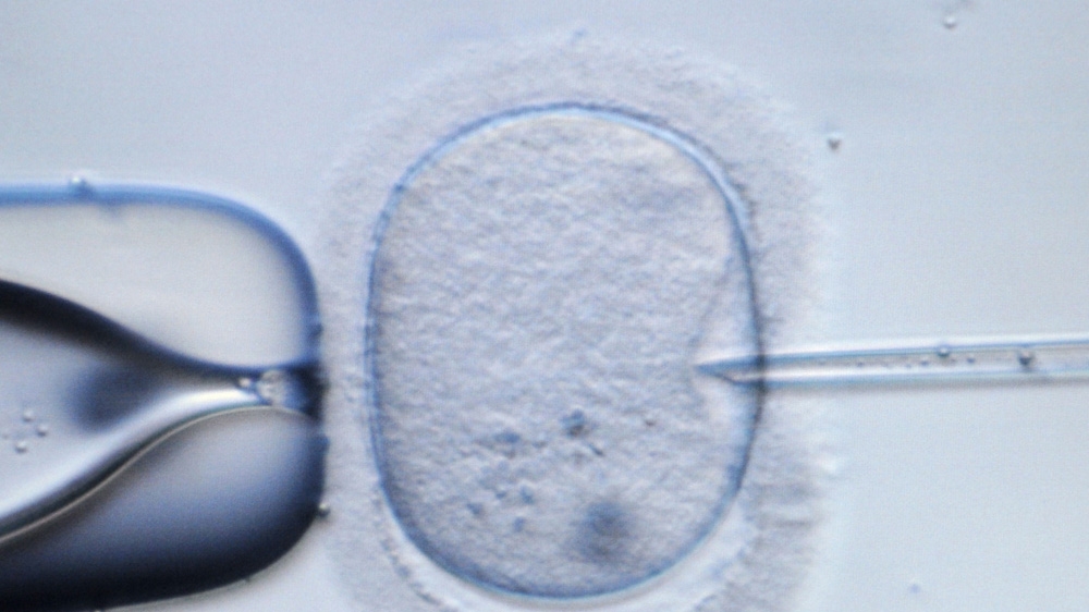 For many couples who cannot conceive, a process known as In Vitro Fertilisation (IVF) is often their only hope [EPA] 