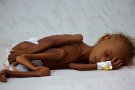 A Yemeni child lies on a bed at a malnutrition intensive care unit at a hospital in the Red Sea port city of Hodeida
