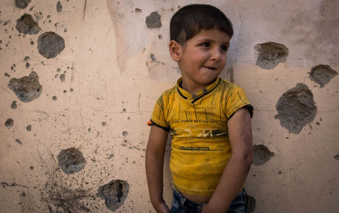Picture 2 A child lays back against the wall of his house riddled with bullets. 3 years ago, Islamic State group took position of the neighbourhood. Kaiwan got his left arm burned while trying to flee