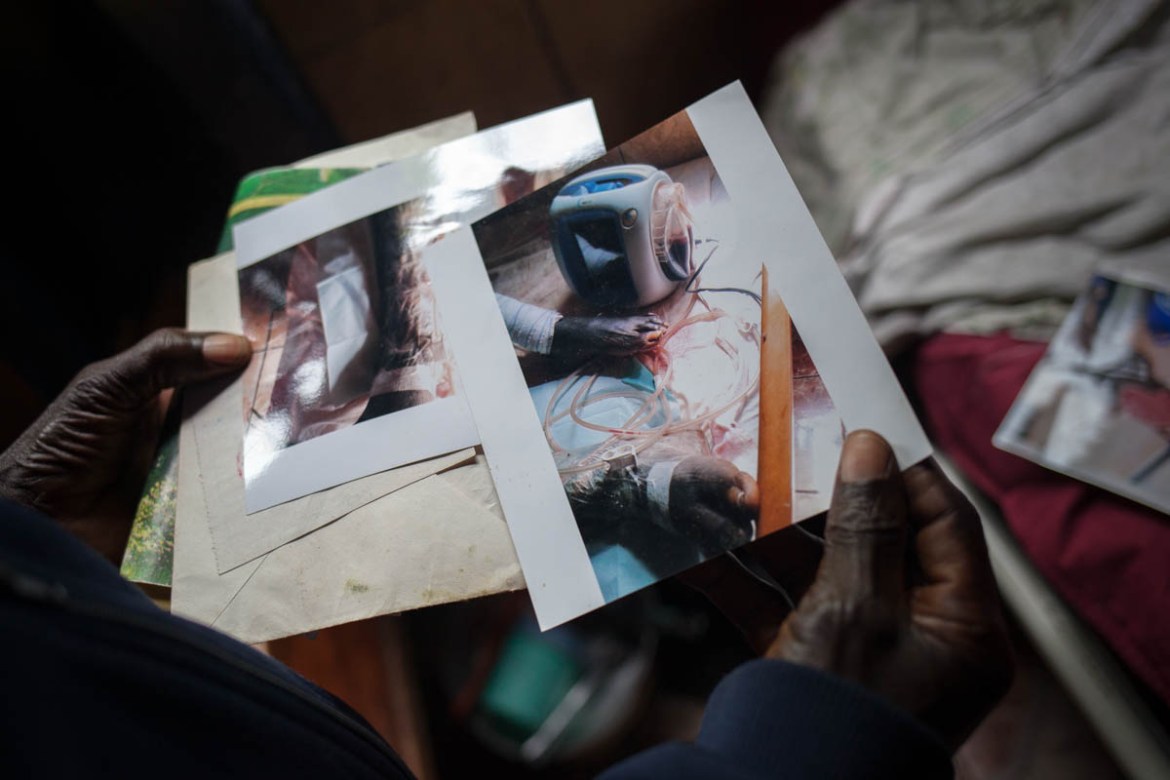 Sylvestre Tchokosseu, 61, shows photos of the moment he was installed a VAC, a negative pressure device. He drove more than eight hours from southern Cameroon to the wound hospital to treat his ulcera