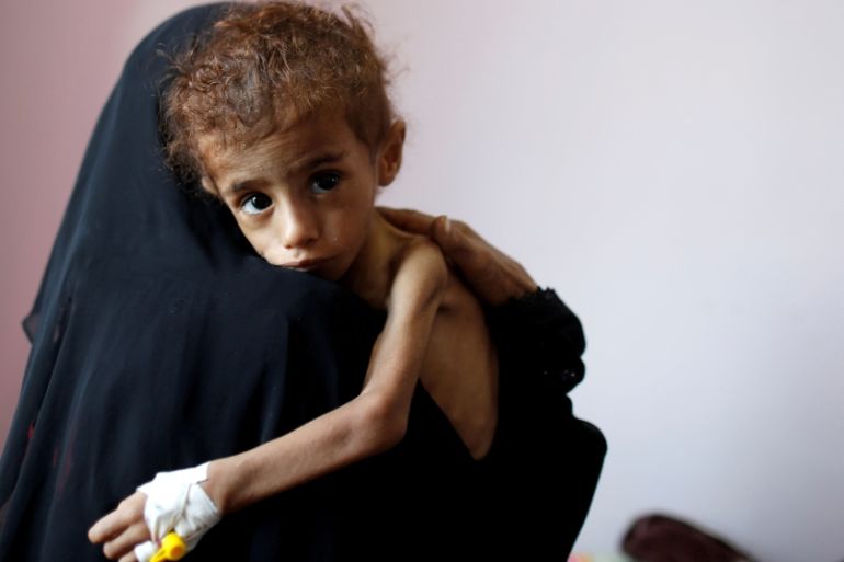 A woman holds a malnourished boy in a malnutrition treatment centre at the al-Sabeen hospital in Sanaa, Yemen October 6, 2018. REUTERS/Khaled Abdullah TPX IMAGES OF THE DAY