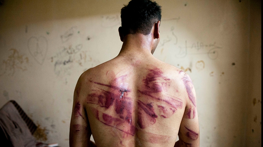 Syria torture 