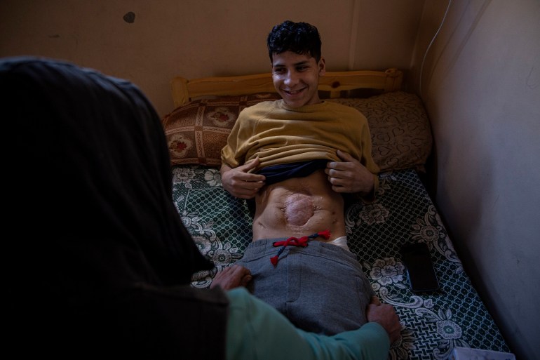 Mahmoud Naim, 18, lies on his bed after he was paralyzed when a shrapnel pierced his back. 