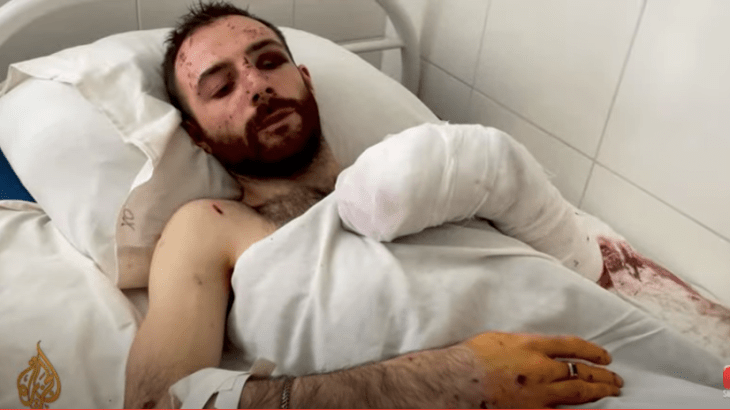 An injured man lies in a hospital bed in Kharkiv, eastern Ukraine