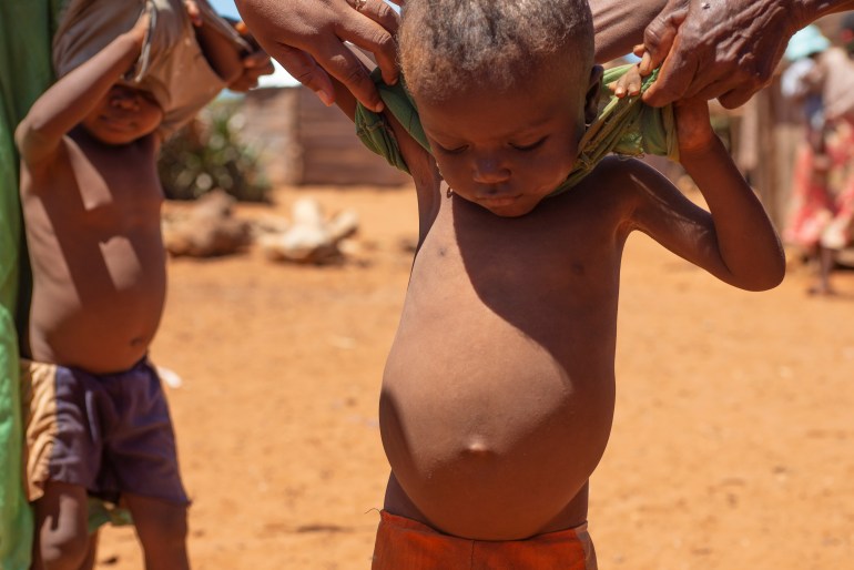 Madagascar hunger