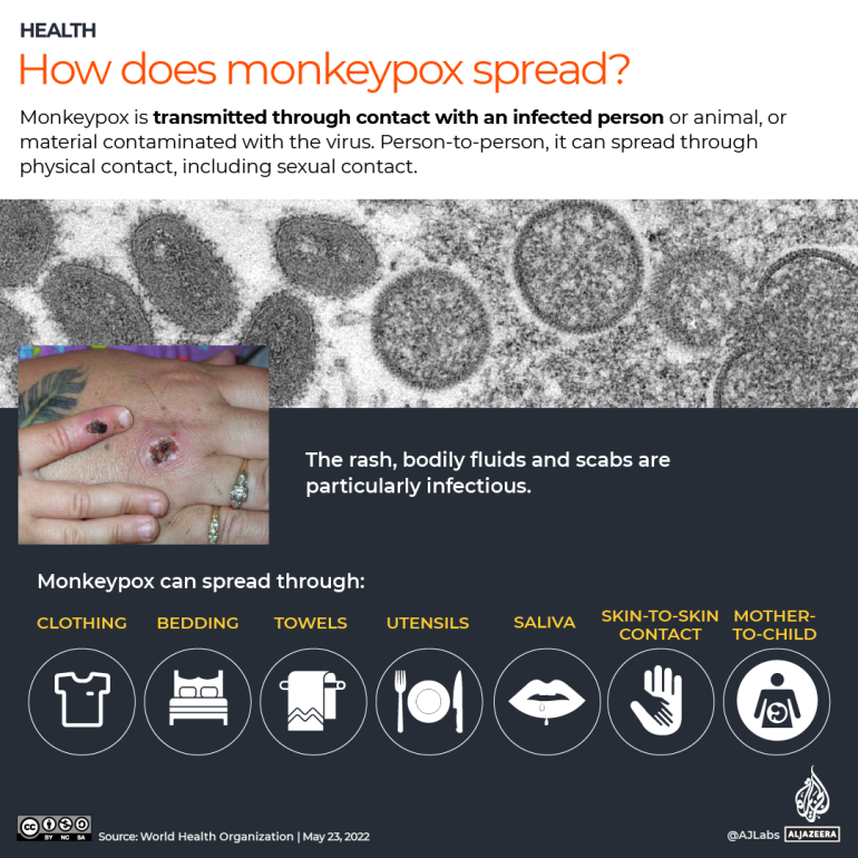 INTERACTIVE- How does monkeypox spread infographic
