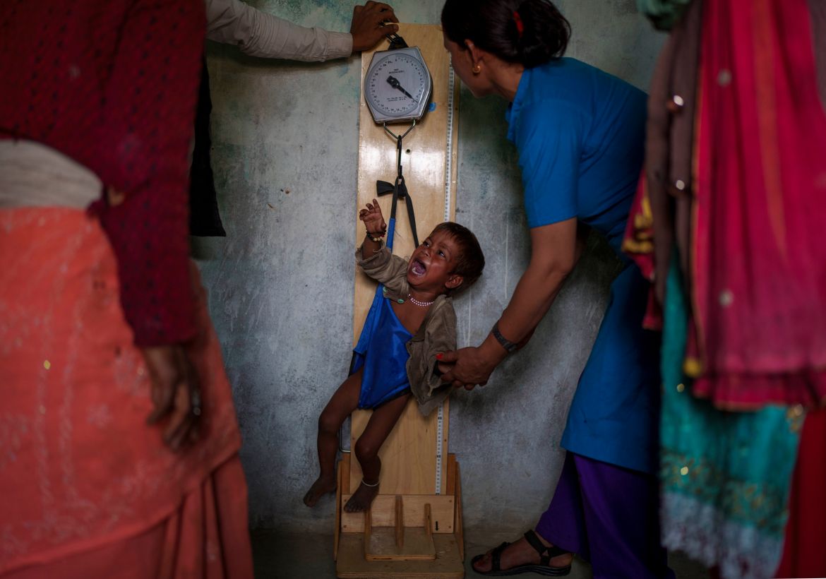 Health worker check weight of a malnourished child