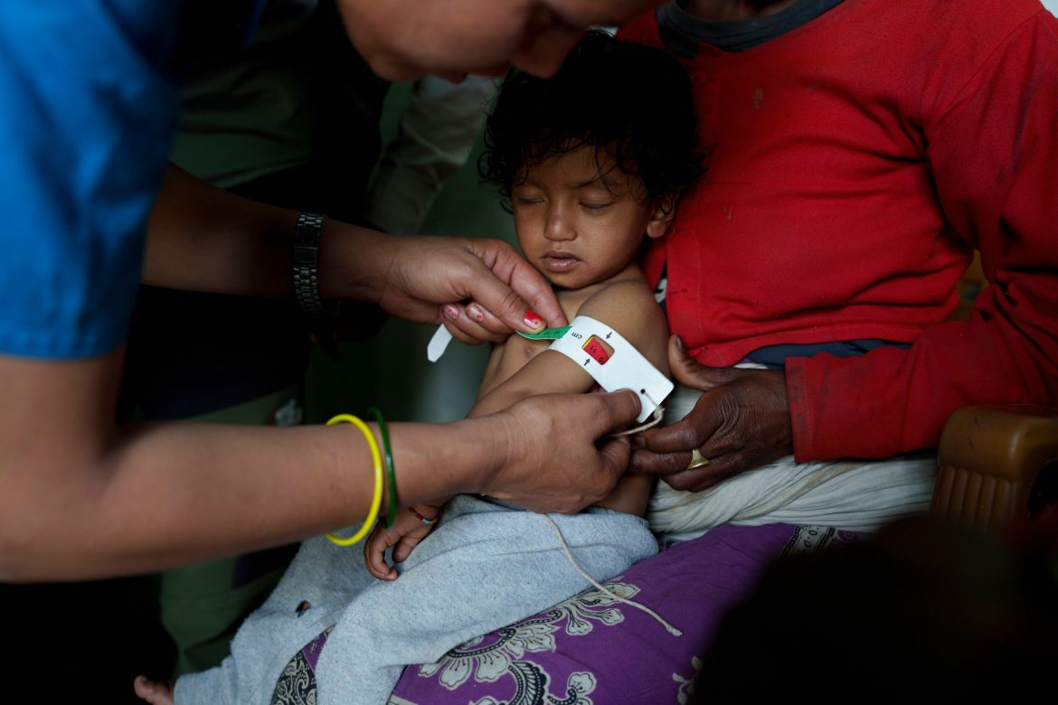 A Health worker measures the circumference of the mid-arm of a malnourished child