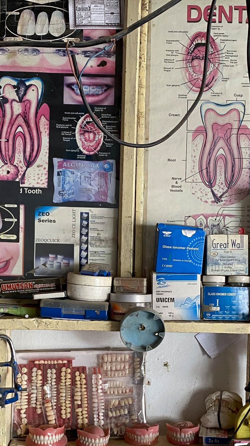 A photo of a shelf with samples of different dentures and two posters on a wall with diagrams for teeth.