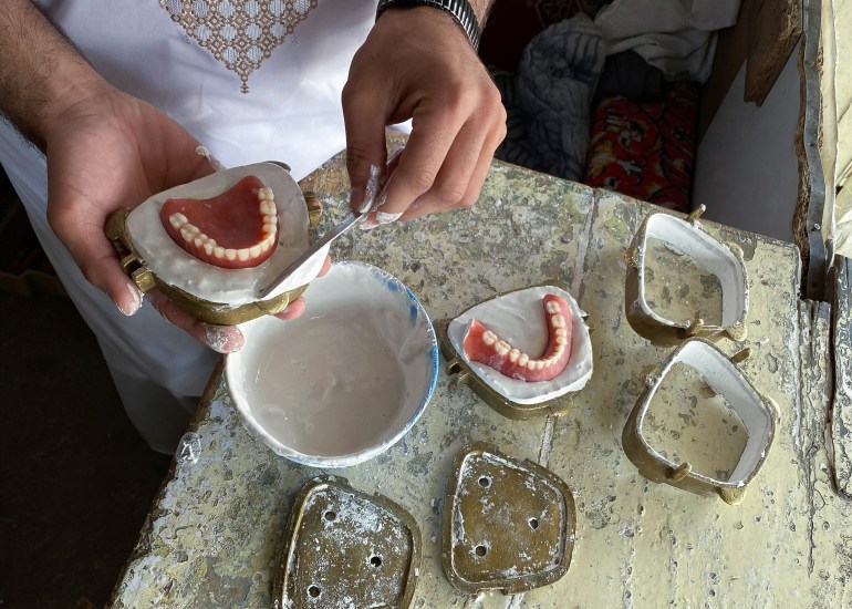 A photo of to-be dentures on a table and someone making a pair of dentures.