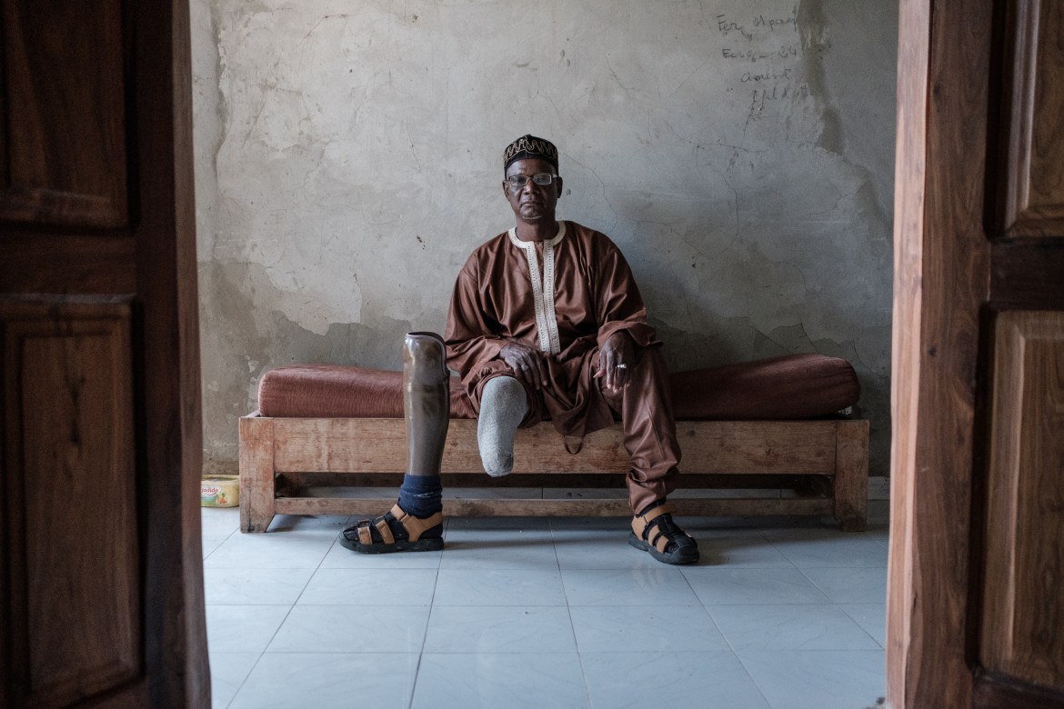 A landmine victim in Casamance, Senegal