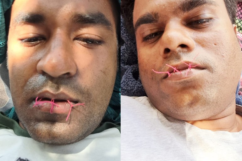 Composite image of Mohammad Shofigul Islam and Mohammad Kaium with their lips sewn shut.