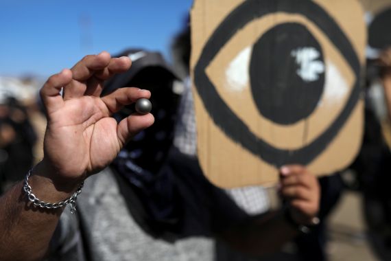 A demonstrator in Chile holds a placard depicting an eye while showing a rubber bullet.