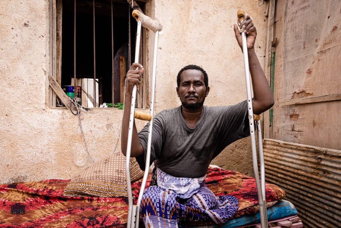 Rodo Abdi, a restaurant owner, lost his leg after his house in Las Anod was hit by shelling