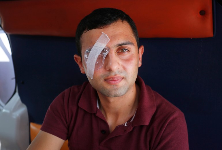 Saeed Imran, 23, has shrapnel stuck inside his right eye