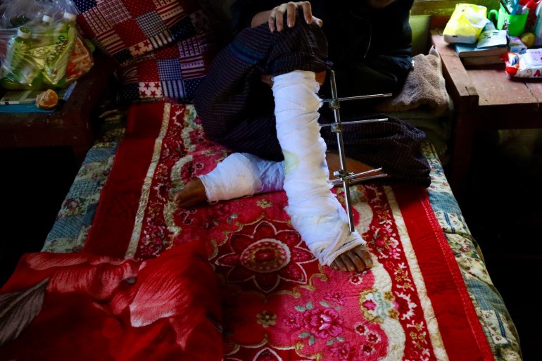 An anti-coup fighter shows his bandaged legs from a landmine injury