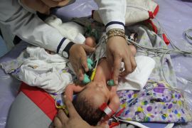 Medical staf treat a baby, hospitalized due to malnutrition and dehydration, at Kamal Adwan Hospital in Beit Lahia, Gaza on Saturday [Mahmoud Issa/Anadolu Agency]