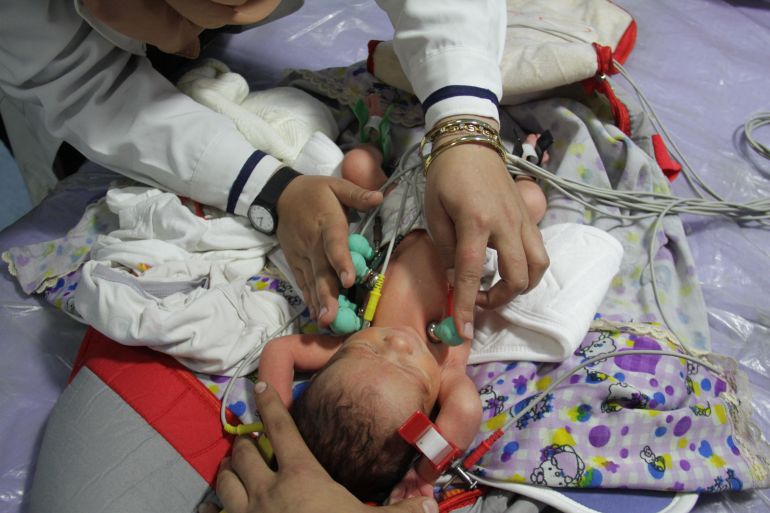A medical staff tries to treat a baby, hospitalized due to malnutrition and dehydration, at Kamal Adwan Hospital in Beit Lahia, Gaza on March 2
